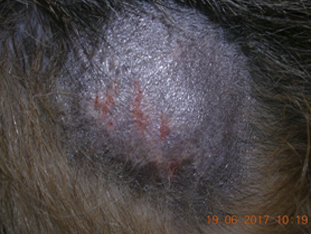 Лечение пиотравматического дерматита у собаки thumbnail