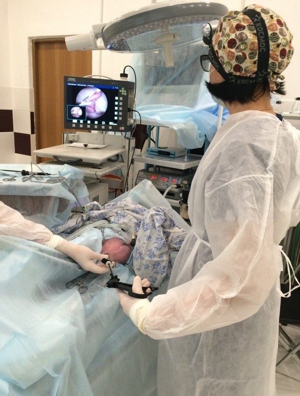 лапароскопия