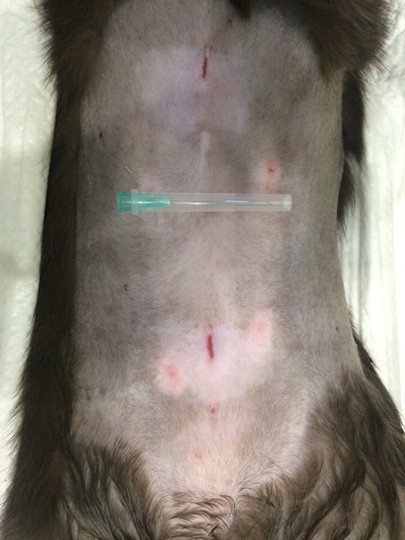 лапароскопия