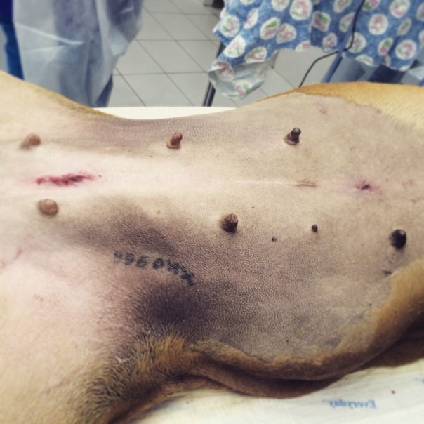 лапароскопия