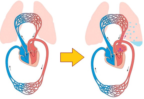Эндокардиоз митрального клапана. Эндокардиоз митрального клапана стадии с. Эндокардиоз атриовентрикулярных клапанов у собак. Acvim классификация. Эндокардиоз у собак прогноз.
