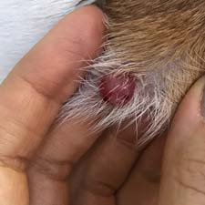 гистиоцитома