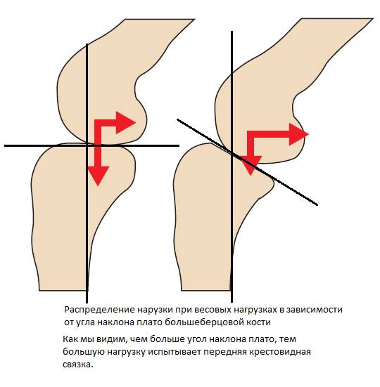 Свой Доктор. Статья для Владельцев. Разрыв передней крестовидной связки. Какую операцию выбрать?
