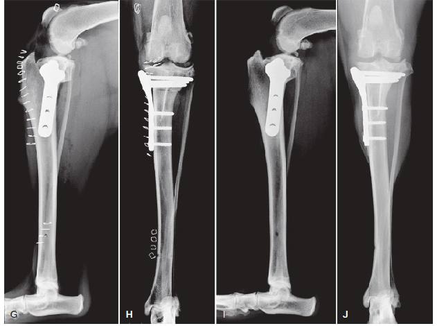 Свой Доктор. Статья для Владельцев. Разрыв передней крестовидной связки. Какую операцию выбрать?
