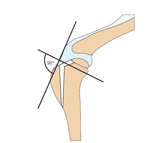 Свой Доктор. Статья для Владельцев. Разрыв передней крестовидной связки. Какую операцию выбрать?