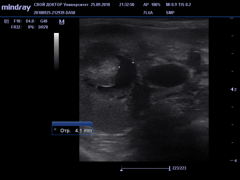 Острая почечная недостаточность у кошки