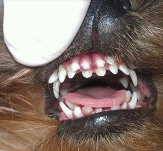 Рис. 5 Аномальная скученнность зубов 