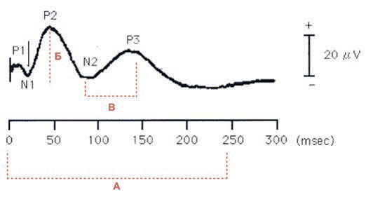 <p>Рис. 3. Схематичное изображение компонентов зрительно вызванных потенциалов на графике: латентное время (a), амплитуда