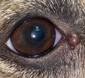 Фото 3. Гистиоцитома кожи