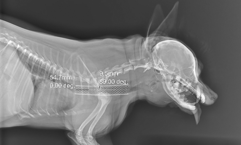 Рентгеновский  снимок после стентирования