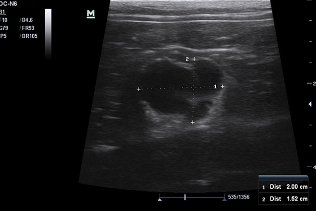Клинический случай, филиал Молодежная.